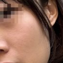 엠스퀘어플러스 서편 | 전주 효자동 피부 관리 추천 뷰티시크릿 트라이엄 레이저