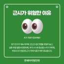연세아이빛안과의원 네이버블로그