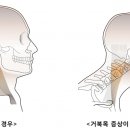 더우아 이미지