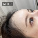 리아이윤 | 성신여대 속눈썹펌 추천 리아이윤 블랙 틴팅+영양 후기