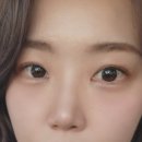 아이온안과의원 이미지