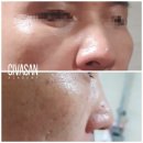 아리아뷰티 네이버블로그