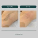 in_waxing 이미지