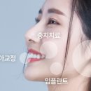 성남타임치과 네이버블로그