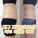 공주사 | 대구 지방분해주사 복부 아랫배 3회차 리얼 만족후기