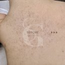 해운대 센텀 피부관리실 썸굿 피부샵 모공각화증 웨딩관리