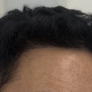 모디헤어플란트의원 이미지