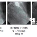 환절기에 더욱 위험한 심·뇌혈관 질환 이미지