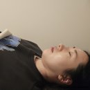 영광한의원 | 내돈내산 부산 서면역 수두 흉터 제거 한의원 새살침 2회차 솔직후기 (여드름흉터전문)