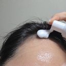 카페인헤어 | 닥터토비아 모낭활성제 카페인 헤어인핸싱폼 추천 후기, 잔머리 변화 직접 경험