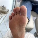 푸스케어서면부전점핑풋 | 핑풋 푸스케어 서면부전점 발톱관리 한달후기!