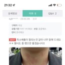 엄마가 효소 받아왔는데 독소배출이랍시고 알러지처럼 올라오는데;; 이거 괜찮은거같음? 이미지