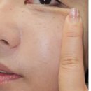 주식회사 청담집 | 청담샵눈가앰플 링클톡스 5D 샷 눈꺼풀 처짐 홈케어 후기