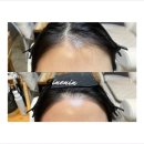 (주)인앤인디자인 | 수원왁싱 인앤인왁싱, 피부 관리 성공 전략과 올바른 선택 노하우