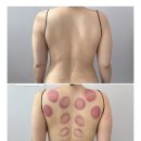 블루에너지 | 평택바디관리 잘하는 블루딥에서 바디 에너지테라피 받은 후기