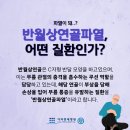 등산 중 무릎에서 통증이? 김포정형외과에서 이미지