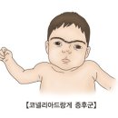 코넬리아드랑게 증후군[Cornelia de Lange syndrome]유전질환 이미지