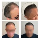 어드반SMP 이미지