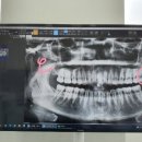 봄빛치과의원 이미지