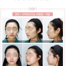 윤곽