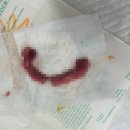 1.8kg 포메라니안 암컷 중성화 후기｜청주 오창 스타동물병원 수술비용·회복과정 공개