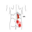 돌아누울 때, 일어설 때 허리 통증 수원바른무릎운동센터 영상 후기