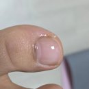 네일바름 | 발톱케어 추천! 바름 뉴트리토 네일 리페어 앰플로 문제성 손발톱 고민 해결 후기