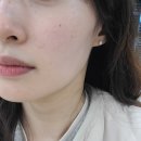 임한의원 | [다산 피부관리 리타임뷰티] 30대, 갑자기 찾아온 불청객 트러블! 트러블 관리 후기