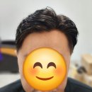 원헤어가발점 | 남자 부분가발 가격 이마와가르마 솔루션