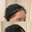 라인뷰티샵 | 다사왁싱 추천, 대실역 슈가링 전문샵 '뷰티유어' 헤어라인·뒷목 왁싱 후기
