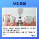 월드치과기공소 이미지