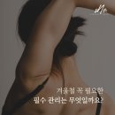 시엔느스킨