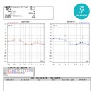 대동 독일보청기 이미지