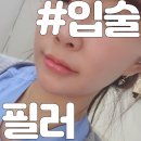 동성로입술필러 모두가 열광하는 그녀들의 핫플!