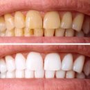 연세한치과의원 이미지