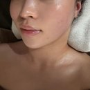 파주 운정동ㅣ여름철 피부관리 추천 닥토필 솔직후기 비엔비 스파 에스테틱ㅣ운정 피부관리