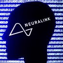 머스크의 뉴럴링크(Neuralink), 마비 환자를 위한 뇌 이식 인간 실험 시작 이미지