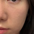 해바라기한의원 | 성남 경락 가인미가 분당데콜테 신부관리 받고 온 후기