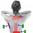 등과 허리의 제1통증~제4통증까지 모조리 잡기 이미지
