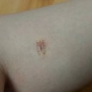 와인피부과의원 | 젊음을 돈으로 산다 아자스!