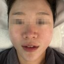 에르떼_익산 모현동 에스테틱 피부관리 후기