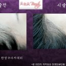 미앤미헤어라인