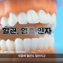 생리할 때 잇몸이 아픈 이유(뜻밖의 생리통) 이미지