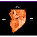 리온메디 이미지