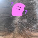 고운세상코스메틱평촌 - 안양시 동안구 시민대로 181 | 두피에 갑자기 생긴 점 뭐지? 평촌 고운세상 진료 후기까지!