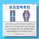 다리에 혈관이 보이는데 하지정맥류일까요? 이미지