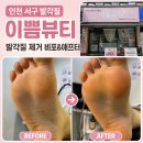 미가림 동안피부 & 발관리 | 인천 서구 발각질 관리, 연희동 이쁌뷰티 여성 발각질 제거 후기