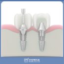 맥치과기공소 이미지