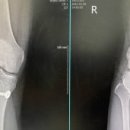 홍프로짐 이미지