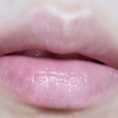 엔티디